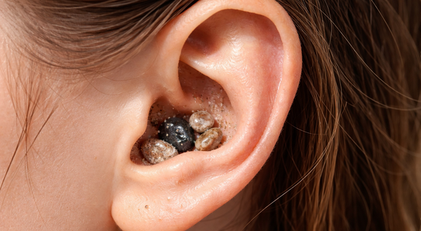 Туристы как контрабандисты: попавшая на пляже в ухо песчинка может стоить свободы